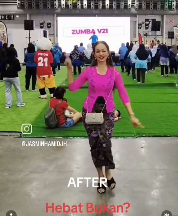 Gambar terkini Jasmin Hamid selepas menjalani pembedahan bariatrik.