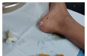 Tong sampah kotor tak diurus, kanak-kanak cedera kaki digigit tikus