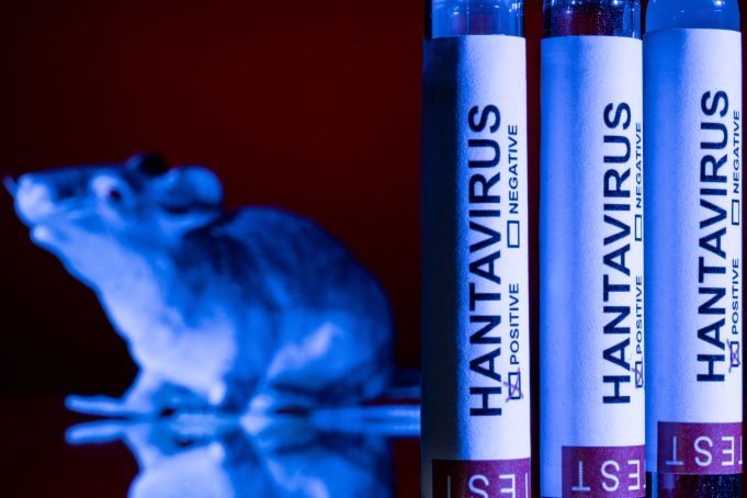 34-1-hantavirus