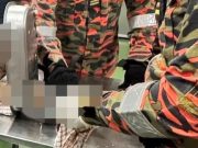 Jari pekerja wanita hancur, putus tersepit mesin kisar kilang