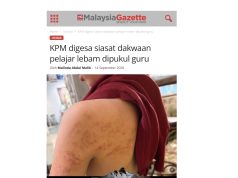 Pelajar lebam dipukul : JPN P.Pinang jalankan siasatan, guru terbabit ditempatkan di PPD