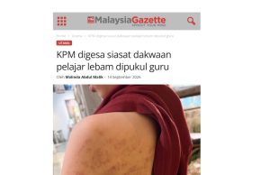 Pelajar lebam dipukul : JPN P.Pinang jalankan siasatan, guru terbabit ditempatkan di PPD
