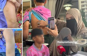 Ibu dakwa anak dipukul dengan batang penyapu, dibelasah 2 jam